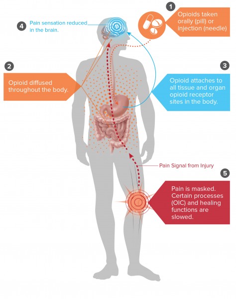 diagram of body brain opioid addiction